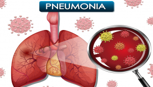 pneumonia