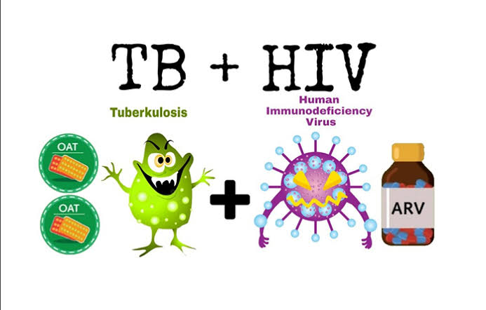 TB-HIV. (Ilustrasi: Ners Unair)