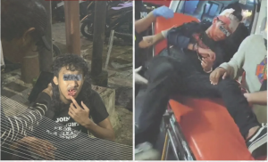 Mahasiswa IMM Aufklarung Diduga Dipukuli Aparat Saat Demo, Tangan Diborgol di Atas Tandu