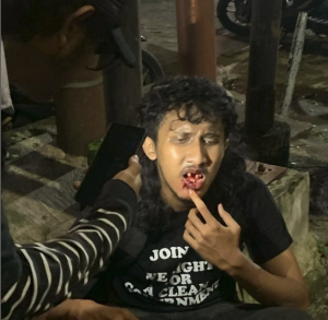 Kronologis Bentrokan dalam Aksi Tolak UU TNI di Kota Malang