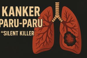 Kanker Paru-paru Jadi Silent Killer, Banyak Gejala Masih Terabaikan