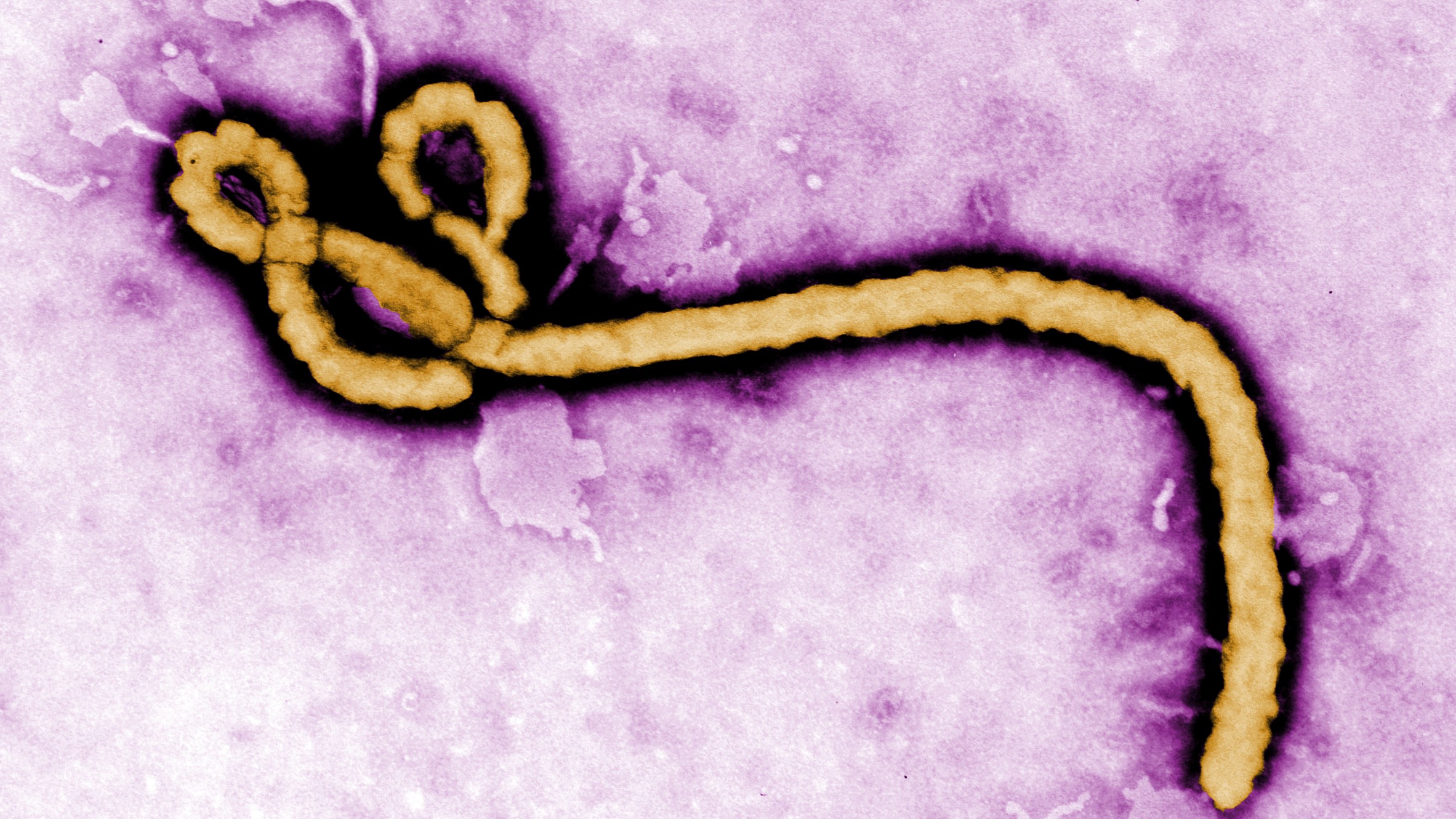 Indonesia Diminta Siaga Hadapi Ancaman Ebola, Lonjakan Kasus di RD Kongo Jadi Sinyal Waspada